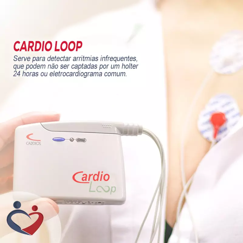 CardioLoop